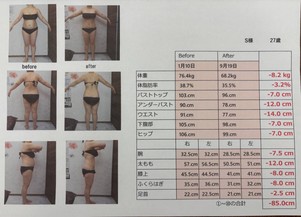 セルライトゼロ