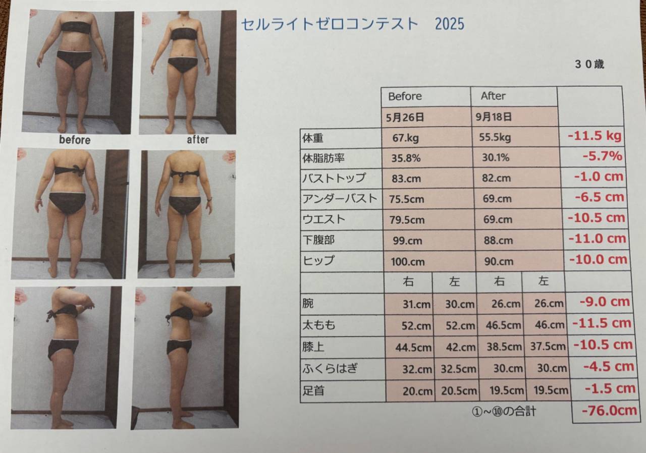 セルライトゼロコンテスト7年連続受賞